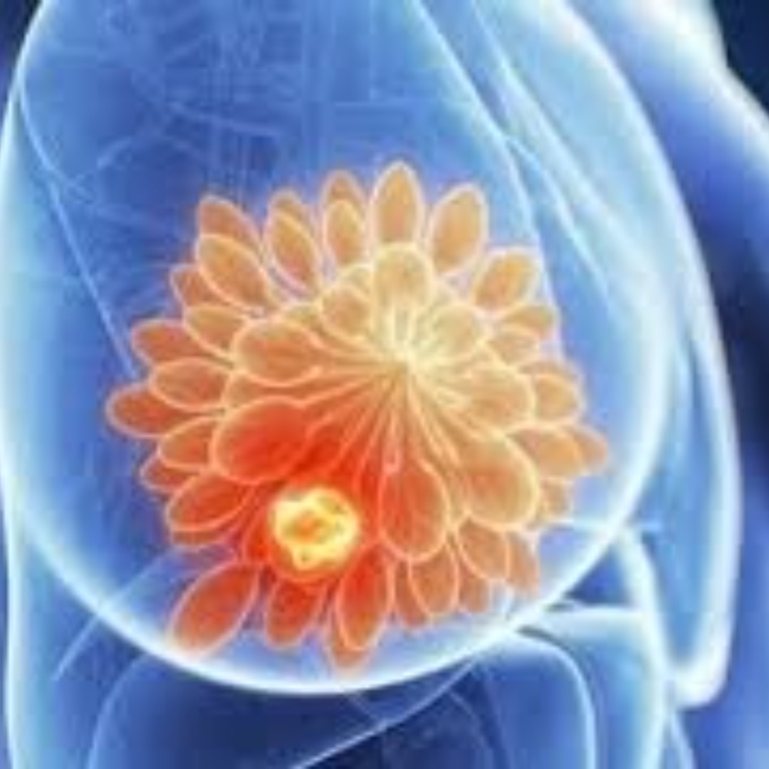 O que é a biópsia? Explicamos aqui!