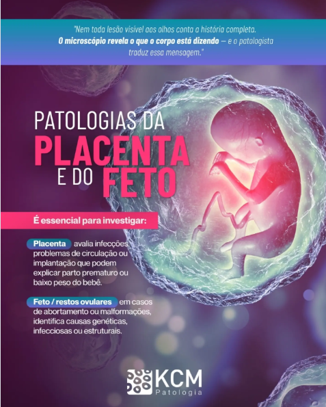 Patologias da Placenta e do Feto