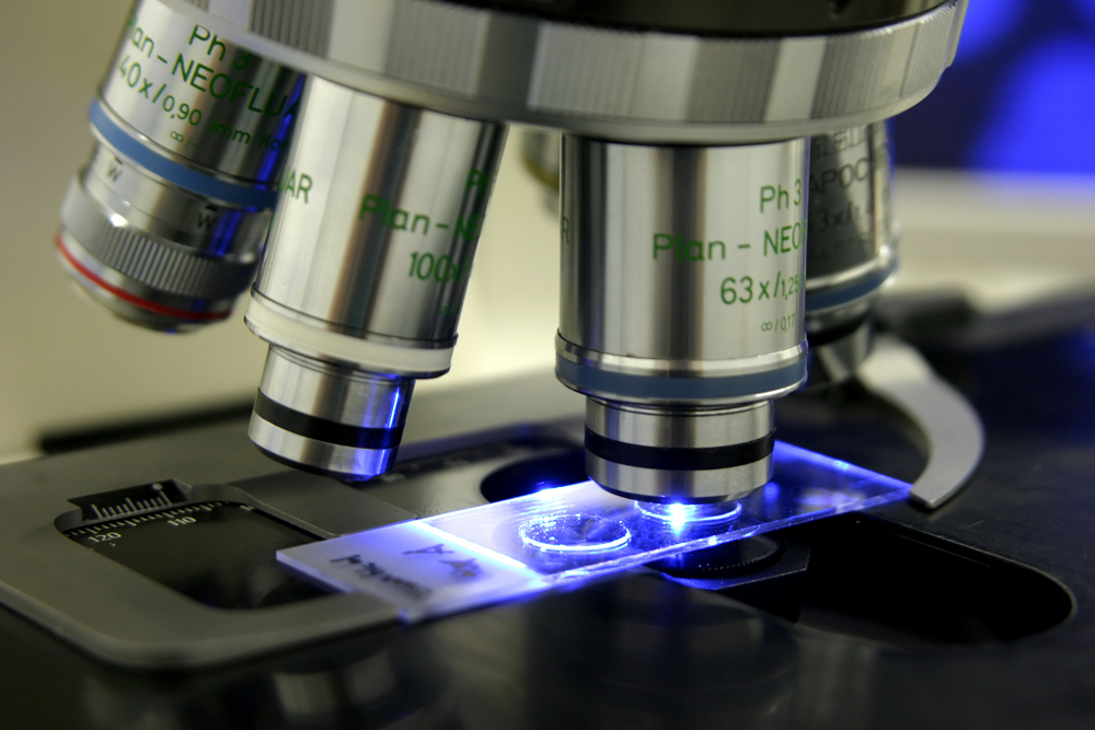 Diagnóstico do câncer: as etapas até o laudo anatomopatológico